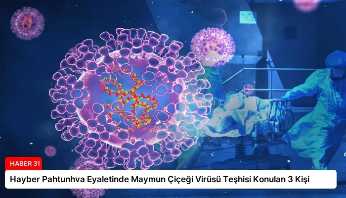 Hayber Pahtunhva Eyaletinde Maymun Çiçeği Virüsü Teşhisi Konulan 3 Kişi