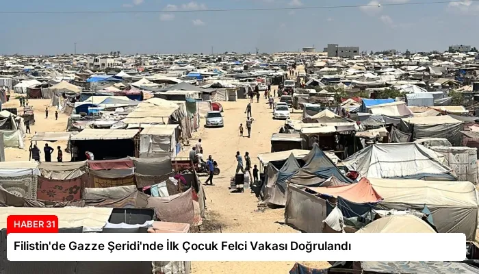 Filistin’de Gazze Şeridi’nde İlk Çocuk Felci Vakası Doğrulandı