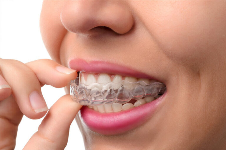 Diş Eti Sorunlarına Son: Yenilikçi Periodontoloji Tedavi Yöntemleri