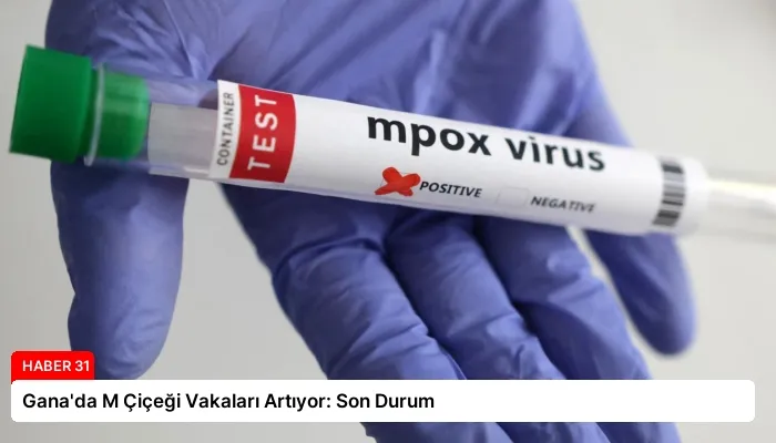 Gana’da M Çiçeği Vakaları Artıyor: Son Durum